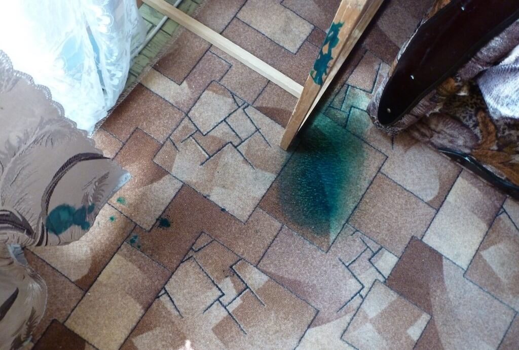 Как быстро отмыть зеленку с кожи, линолеума, одежды, мебели и других поверхностей