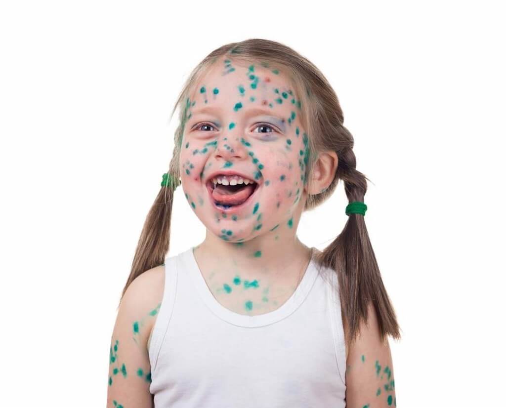 Как быстро отмыть зеленку с кожи, линолеума, одежды, мебели и других поверхностей