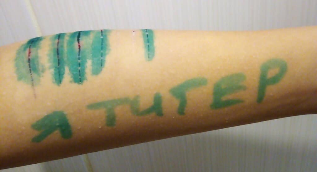 Как быстро отмыть зеленку с кожи, линолеума, одежды, мебели и других поверхностей